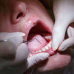 Una sigilosa bacteria podría esconderse en tus encías y causar daños cardíacos