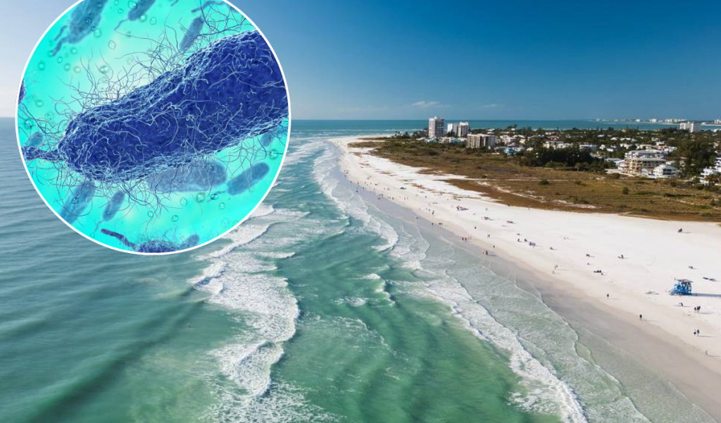 Autoridades confirman 4 muertes por bacteria “come carne” en Florida