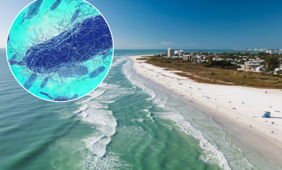 Autoridades confirman 4 muertes por bacteria “come carne” en Florida