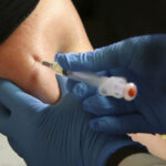 Sarampión reaparece en Florida y expertos advierten sobre riesgos y baja cobertura vacunal