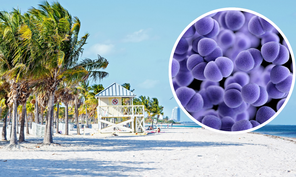 Alerta sanitaria en Key Biscayne: detectan altos niveles de bacteria fecal en playa de Crandon Park