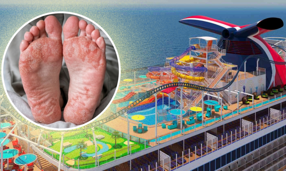 Pasajero demanda a Carnival por $5 millones tras quemarse los pies en un crucero