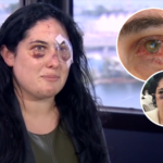 Mujer apuñalada con bolígrafo en Downtown Miami quedó parcialmente ciega
